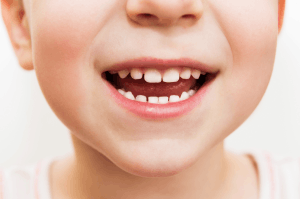 Featured Image for childs mouth smiling