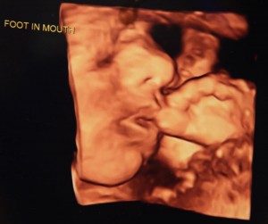 fetal ultrasound