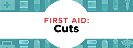 first aid for cuts