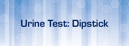 Kidshealth: Urine Test: Dipstick | Akron Children's Hospital